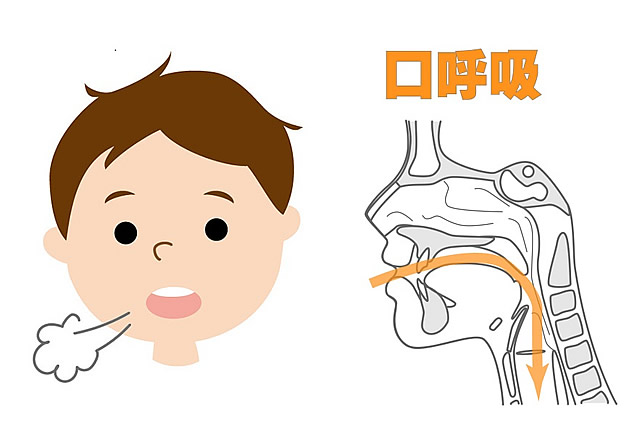 口呼吸とかみ合わせ