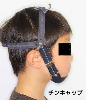 チンキャップ