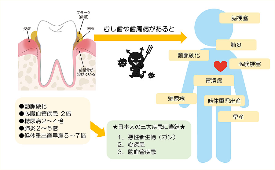 全身疾患